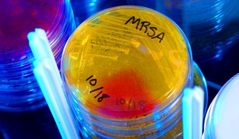 Methicillin-resistant Staphylococcus aureus (MRSA) in a Petri Dish. Source: RKI.