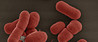 Cutout: Acinetobacter baumannii. Electron microscopy. Source: © Gudrun Holland; Colouring: Michael Laue/RKI