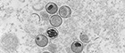 Monkeypox virus, MPXV; Poxviridae; Chordopoxvirinae. Transmission electron microscopy ultra thin section. Bar = 200 nm. Source: Freya Kaulbars/RKI