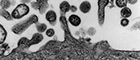 Cutout: Lymphocytic choriomeningitis virus (Arenavirus). Transmission electron microscopy, ultra thin section. Bar = 200 nm. Source: © Hans R. Gelderblom, Freya Kaulbars/RKI