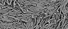 Cutout: Bacillus cereus, colony, vegetative Bacteria (predominantly in chains). Electron microscopy. Bar = 5 μm. Source: © RKI