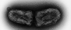 Cutout: Brucella melitensis biovar abortus ((Brucella). Transmission electron microscopy, negative staining. Initial magnification x 40000. Source: © RKI
