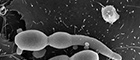 Cutout: Candida albican. Electron microscopy. Bar = 2 µm. Source: © Muhsin Özel, Gudrun Holland/RKI