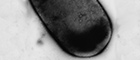 Cutout: Clostridium perfringens. Transmission electron microscopy, negative staining. Bar = 500 nm. Source: © RKI