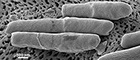 Cutout: Clostridium difficile NCTC 13307 (Clostridia), cluster of bacteria. Scanning electron microscopy. Bar = 500 µm. Source: © Norbert Bannert; Lars Möller/RKI