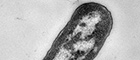 Cutout: Enterohemorrhagic Escherichia coli (EHEC) of the serotype O104:H4. Electron microscopy, negative staining. Bar = 500 nm. Source: © Michael Laue, Janett Piesker/RKI