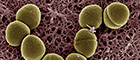 Cutout: Enterococcus faecalis OG1RF34. Bacteria on Agar. Scanning electron microscopy. Imaging: Gudrun Holland/RKI. Coloration: Tim Bergner/RKI