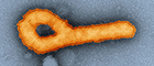 Cutout: Electron microscopy of Ebola viruses (coloured). Source: © Tobias Hoffmann, Andreas Kurth (2019)/RKI