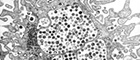 Cutout: HIV-1 on H9. Human T-cell leukemia (lymphotropic), Infection with HIV-1 (retroviruses). Negative staining, Transmission electron microscopy. Bar = 500 nm. Source: © Hans R. Gelderblom/RKI