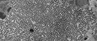 Cutout: Human papillomavirus, HPV. Biopsy human warts. Electron microscopy, ultrathin section. Bar = 1µm. Source: © Hans R. Gelderblom (1981)/RKI