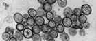 Cutout: Puumala virus (Hantaviruses). Transmission electron microscopy, ultrathin section. Bar = 200 nm. Source: © RKI