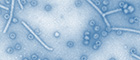 Cutout: Hepatitis B virus, HBV, primary magnification x 50000, genetically engineered HBV cores; colored. Source: © Muhsin Özel/RKI