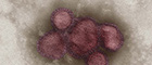 Cutout: Influenza A virus A/California/7/2009 (H1N1), colouring, negative staining, Transmission-electron microscopy (TEM). Initial magnification x 85000. Source: © Gudrun Holland, N. Bannert/RKI