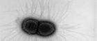 Cutout: Klebsiella pneumoniae.  Transmission electron microscopy, negative staining. Bar = 1 µm. Source: © Hans R. Gelderblom, Andrea Männel, Rolf Reissbrodt/RKI