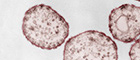 Cutout: Measles virus (Paramyxoviridae). Transmission electron microscopy ultra thin section. Bar = 200 nm. Source: © Hans R. Gelderblom, Freya Kaulbars. Colouring: Andrea Schnartendorff/RKI