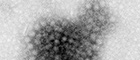 Cutout: Norwalk-like Virus (Caliciviridae). Transmission electron microscopy, negative staining. Bar = 100 nm. Source: © Michael Laue/RKI