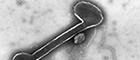 Cutout: Paramyxovirus, Transmission electron microscopy, negative staining. Source: © Hans R. Gelderblom/RKI