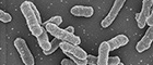 Yersinia pestis, colony. Scanning-electron microscopy. Bar = 500 nm. Quelle: © RKI