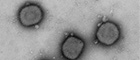 Cutout: Vaccinia virus (Orthopoxviruses), vaccine strain against smallpox. Transmission electron microscopy, negative staining. Bar = 200 nm. Source: © RKI