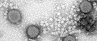 Cutout: RVFV, Rift Valley fever virus MP12 (Bunyavirus). Transmission electron microscopy, negative staining. Bar = 100 nm. Source: © RKI