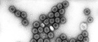 Cutout: HRV, Human rotavirus.Transmission electron microscopy, negative staining. Bar = 100 nm. Source: © Hans R. Gelderblom/RKI