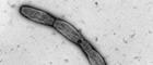 Cutout: Burkholderia mallei, amastigote bacteria (chain forming). Transmission electron microscopy, negative staining. Bar = 1 μm. Source: © RKI