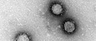 Cutout: Severe acute respiratory syndrome coronavirus (SARS). Transmission electron microscopy, negative staining. Bar = 100 nm. Source: © RKI