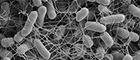 Cutout: Salmonella enterica Subspecies enterica Serovar Typhimurium (Salmonella), colony. Scanning electron microscopy. Bar = 1 μm. Source: © RKI