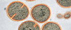Cutout: Staphylococcus aureus. Transmission electron microscopy, ultra thin section. Source: © RKI