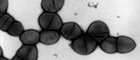 Cutout: Streptococcus pneumoniae (pneumococcus). Transmission electron microscopy,  negative staining. Bar = 1 µm. Source: © Hans R. Gelderblom, Rolf Reissbrodt/RKI