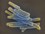 Mycobacterium tuberculosis. Source: © Andrea Schnartendorff/RKI
