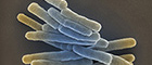 Cutoutt: Mycobacterium tuberculosis. Scanning electron microscopy. Bar = 1 µm. Source: © Gudrun Holland 2013/RKI