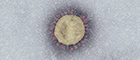 Elektronenmikroskopische Aufnahme von SARS-CoV-2 (eingefärbt). Quelle: Robert Koch-Institut